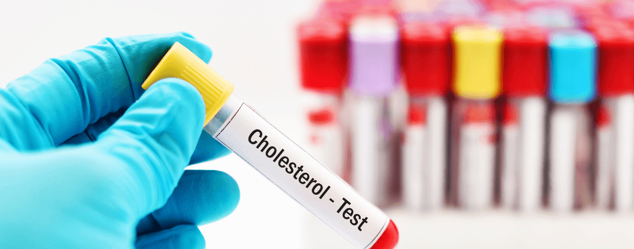 Cholesterol test